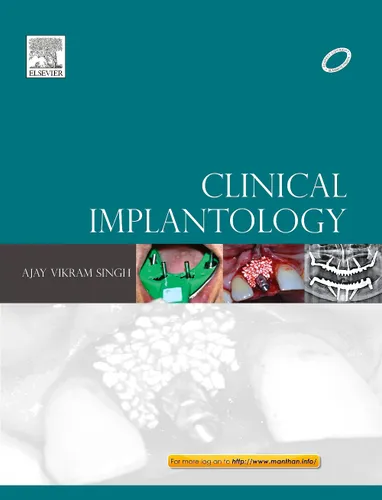 Clinical Implantology; E-Book also available, 1e