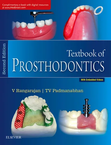 Textbook of Prosthodontics, 2e