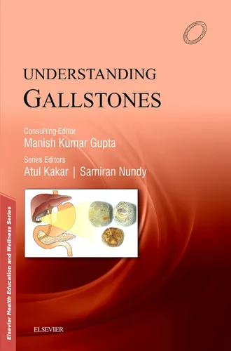 Understanding Gallstones, 1e
