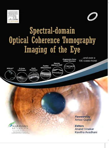 Spectral Domain Optical Coherence Tomography Imaging of the Eye, 1e