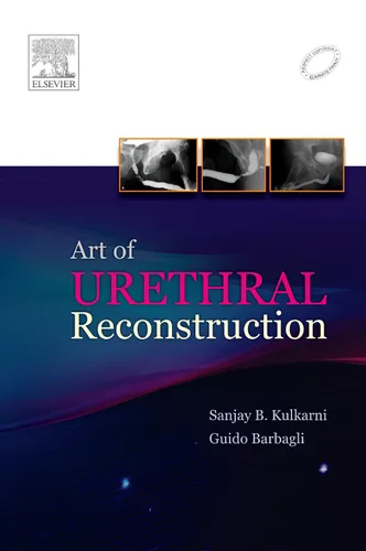 Art of Urethral Reconstruction, 1e