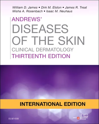 Andrews' Diseases of the Skin, International Edition: Clinical Dermatology, 13e