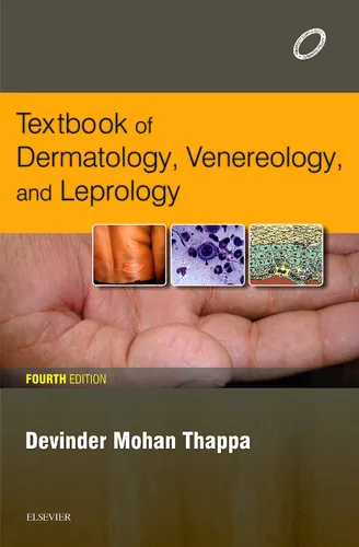 Textbook of Dermatology, Venereology, and Leprology, 4e