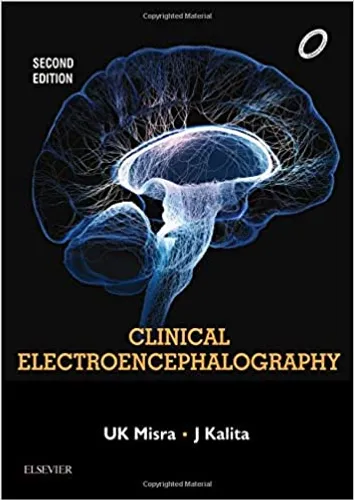 Clinical Electroencephalography, 2e