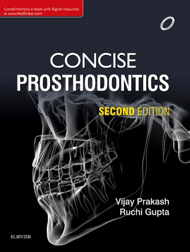 Concise Prosthodontics, 2e