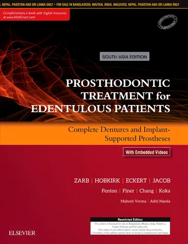 Prosthodontic Treatment for Edentulous Patients: Complete Dentures and Implant-Supported Prostheses: First South Asia Edition