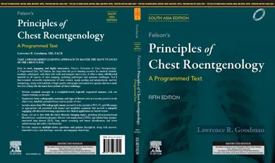 Felson's Principles of Chest Roentgenology