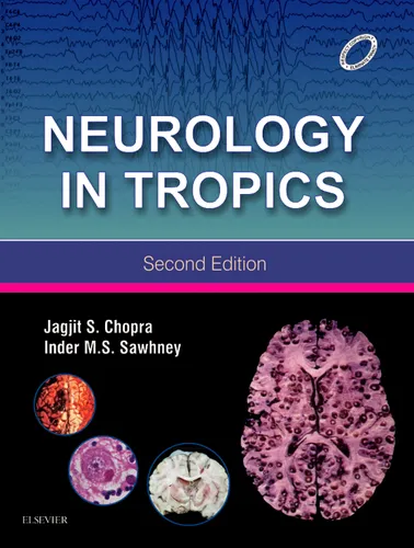 Neurology in Tropics, 2e