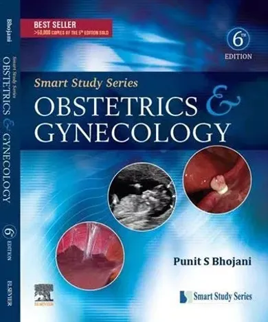 Smart Study Series: Obstetrics and Gynecology, 6e
